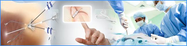 Sleeve gastrectomy surgery in India
