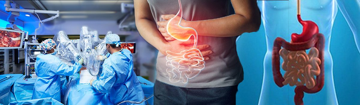 Doctor Consultation For Gastrointestinal Surgery Treatment In Delhi