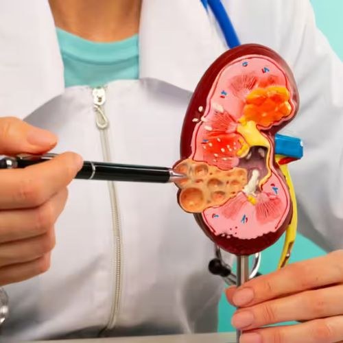 abo incompatible kidney transplant india low cost benefits