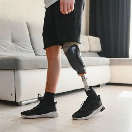 Artificial Limb And Prosthesis Surgery