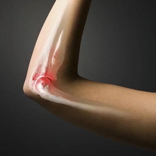 Bone Cancer Treatment And Surgery