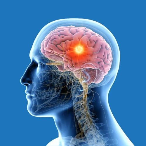 Brain Cancer Surgery