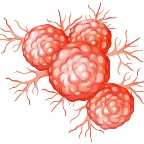 Cancer Surgery In India