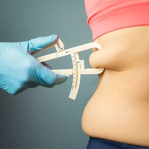 Duodenal Switch Surgery