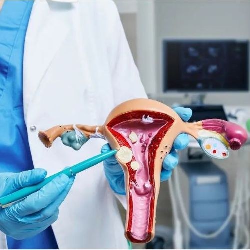 Fibroid Surgery