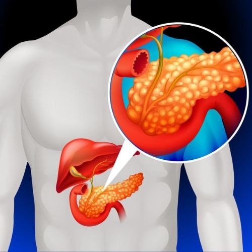 Pancreatic Cancer Treatment And Surgery