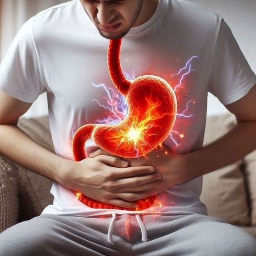 Sleeve Gastrectomy