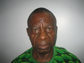 Mr. Ekon Okoro — Prostate Cancer Green Light Laser Surgery India