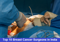 Top 10 Breast Cancer Surgeons in India