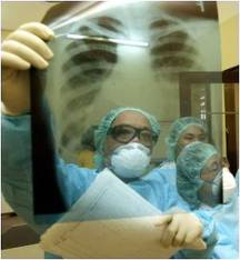 Diagnostic du cancer du poumon