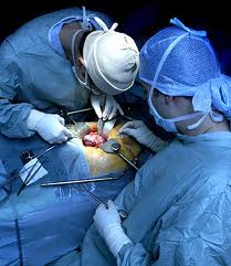 How is Liver Transplantation Procedure done?