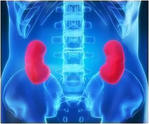 How is the ABO Incompatible Kidney Transplant surgery done