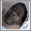 Best Medical Facilities Cervical Lumber Spine Surgery India