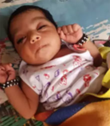 Biliary Artesia Treatment India